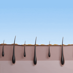 جهاز 5 مينسكين لإزالة الشعر بالليزر في المنزل