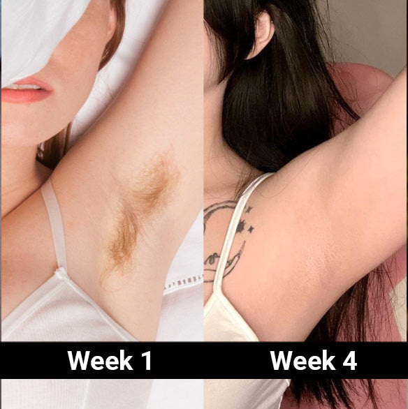 Alvina 💎 on Instagram: #sponsored #5minskin 5MINSKIN HAIR ZAPPER 2.0 -  AT-HOME LASER HAIR REMOVAL HANDSET 🪷Permanent Hair Removal: Start seeing  results in 2- 3 weeks and permanent hair removal in 6-8